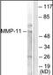 Matrix Metallopeptidase 11 antibody, orb94864, Biorbyt, Western Blot image 