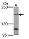 Patched 1 antibody, GTX108015, GeneTex, Western Blot image 
