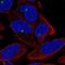 Zinc Finger Protein 766 antibody, NBP2-56347, Novus Biologicals, Immunocytochemistry image 