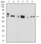 Keratin 5 antibody, NBP2-52443, Novus Biologicals, Western Blot image 