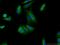 Huntingtin Interacting Protein 1 antibody, 22231-1-AP, Proteintech Group, Immunofluorescence image 