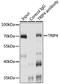 Thyroid Hormone Receptor Interactor 4 antibody, GTX66364, GeneTex, Immunoprecipitation image 