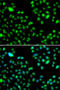 L3MBTL Histone Methyl-Lysine Binding Protein 3 antibody, STJ29428, St John