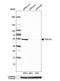 Tumor Susceptibility 101 antibody, NBP1-80659, Novus Biologicals, Western Blot image 