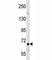 TNF Receptor Superfamily Member 21 antibody, F45509-0.4ML, NSJ Bioreagents, Western Blot image 