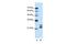 Cold Shock Domain Containing C2 antibody, GTX47321, GeneTex, Western Blot image 