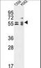 Tubulin-specific chaperone E antibody, LS-C161742, Lifespan Biosciences, Western Blot image 