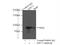 Kinesin-like protein KIFC3 antibody, 10125-2-AP, Proteintech Group, Immunoprecipitation image 