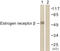 Estrogen Receptor 2 antibody, LS-C117893, Lifespan Biosciences, Western Blot image 