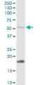 Protein Phosphatase, Mg2+/Mn2+ Dependent 1J antibody, H00333926-D01P, Novus Biologicals, Western Blot image 