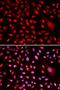 Core-Binding Factor Subunit Beta antibody, orb167219, Biorbyt, Immunocytochemistry image 