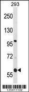 Transmembrane And Coiled-Coil Domains 4 antibody, 58-597, ProSci, Western Blot image 