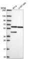 Kelch Like Family Member 12 antibody, NBP2-56310, Novus Biologicals, Western Blot image 