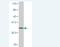 Phospholipase D1 antibody, H00005337-M02, Novus Biologicals, Western Blot image 