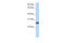 Transmembrane Serine Protease 5 antibody, 30-563, ProSci, Western Blot image 