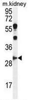 Cyclin G1 antibody, AP50811PU-N, Origene, Western Blot image 
