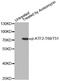 Activating Transcription Factor 2 antibody, MBS128518, MyBioSource, Western Blot image 