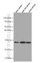 Rho GDP Dissociation Inhibitor Alpha antibody, 66480-1-Ig, Proteintech Group, Western Blot image 