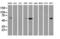 Epsin 2 antibody, LS-C337631, Lifespan Biosciences, Western Blot image 