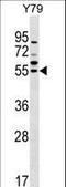 Ferredoxin Reductase antibody, LS-C166116, Lifespan Biosciences, Western Blot image 