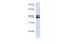 Lipoic Acid Synthetase antibody, A08974, Boster Biological Technology, Western Blot image 