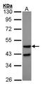 GCGR antibody, PA5-27183, Invitrogen Antibodies, Western Blot image 