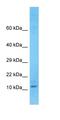 Transmembrane protein 105 antibody, orb327121, Biorbyt, Western Blot image 