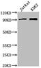 Microtubule Affinity Regulating Kinase 2 antibody, CSB-PA762568LA01HU, Cusabio, Western Blot image 