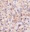 Bruton Tyrosine Kinase antibody, NBP1-78295, Novus Biologicals, Immunohistochemistry paraffin image 