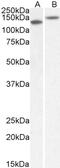 High molecular weight kininogen antibody, 43-476, ProSci, Western Blot image 