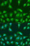 Protein Arginine Methyltransferase 6 antibody, 23-203, ProSci, Immunofluorescence image 