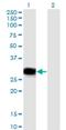 RNA-binding protein with multiple splicing antibody, H00011030-M03, Novus Biologicals, Western Blot image 