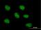 Minichromosome Maintenance 10 Replication Initiation Factor antibody, H00055388-B01P, Novus Biologicals, Immunocytochemistry image 