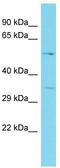 Adenosylhomocysteinase Like 2 antibody, TA332189, Origene, Western Blot image 