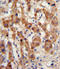 N-Acetyltransferase 2 antibody, LS-C164755, Lifespan Biosciences, Immunohistochemistry paraffin image 