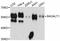 Beta-1,4-Galactosyltransferase 1 antibody, A03993-1, Boster Biological Technology, Western Blot image 