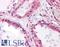 MCF.2 Cell Line Derived Transforming Sequence Like antibody, LS-B4519, Lifespan Biosciences, Immunohistochemistry frozen image 