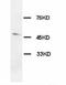 Hypocretin Receptor 1 antibody, LS-C171847, Lifespan Biosciences, Western Blot image 