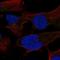 Suppression Of Tumorigenicity 7 Like antibody, HPA075418, Atlas Antibodies, Immunofluorescence image 