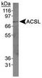 Acyl-CoA Synthetase Long Chain Family Member 1 antibody, TA309563, Origene, Western Blot image 