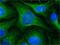 Tubulin antibody, GTX11312, GeneTex, Immunofluorescence image 