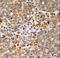AlkB Homolog 3, Alpha-Ketoglutaratedependent Dioxygenase antibody, LS-C156282, Lifespan Biosciences, Immunohistochemistry frozen image 