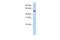 Solute Carrier Family 36 Member 2 antibody, PA5-42529, Invitrogen Antibodies, Western Blot image 