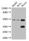 Dynein Axonemal Assembly Factor 4 antibody, CSB-PA855504LA01HU, Cusabio, Western Blot image 