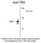 Nuclear Receptor Subfamily 2 Group C Member 1 antibody, 50-146, ProSci, Western Blot image 