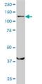 Structural Maintenance Of Chromosomes 6 antibody, H00079677-M01, Novus Biologicals, Western Blot image 