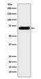 Natriuretic Peptide Receptor 3 antibody, M03589, Boster Biological Technology, Western Blot image 