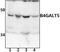 Beta-1,4-Galactosyltransferase 5 antibody, PA5-75965, Invitrogen Antibodies, Western Blot image 