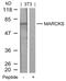 Myristoylated Alanine Rich Protein Kinase C Substrate antibody, GTX50602, GeneTex, Western Blot image 