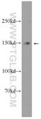 Myotubularin Related Protein 3 antibody, 21336-1-AP, Proteintech Group, Western Blot image 